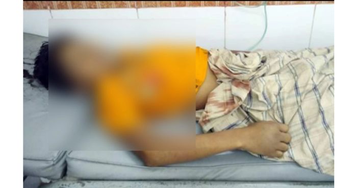 পাখির বাসায় হাতদেওয়া সাপের ছোবল, প্রাণ গেল শিশুর