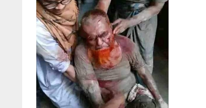 কুমিল্লায় চাঁদা না দেয়ায় বৃদ্ধ আলেমকে পিটিয়ে জখম করলেন আ.লীগ নেতা