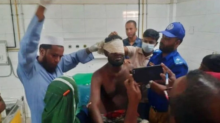 চুরির অভিযোগে যুবককে গণপিটুনি, উপড়ে ফেলা হলো দুই চোখ