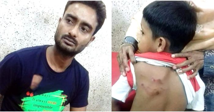 কুমিল্লায় মহালক্ষ্মীপাড়ায় কুকুরের কামড়ে আহত ১১