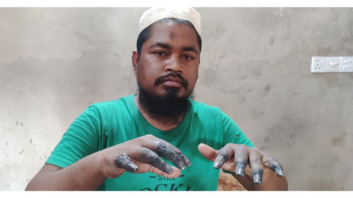 ‘পাথরের মত  শক্ত হয়ে গেছে নুরুলের দুই হাতের আঙুল