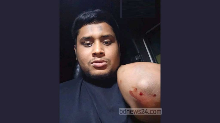 হাসনাতের গাড়িবহরে হামলা: মামলা ১০০ জনের বিরুদ্ধে