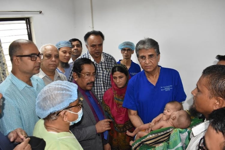 বিএসএমএমইউয়ে আলাদা হল পেটে ও বুকে জোড়া লাগানো দুই শিশু