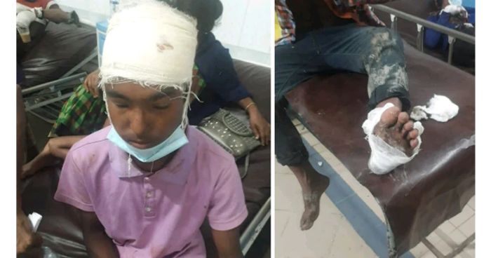 ইমাম-মুয়াজ্জিনকে খাওয়ানো নিয়ে সংঘর্ষে গুলিবিদ্ধসহ আহত ৪০