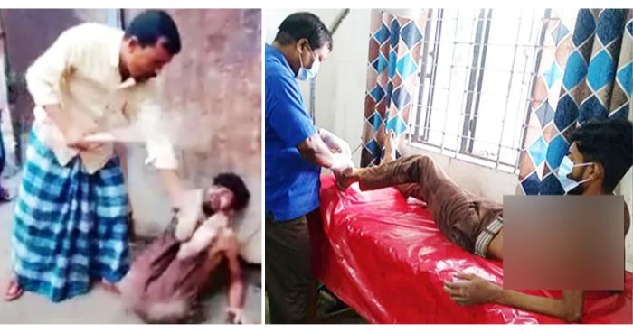 বগুড়া কাহালুর গ্রামে চোর সন্দেহে যুবকের পায়ে পেরেক পুঁতে নির্যাতন
