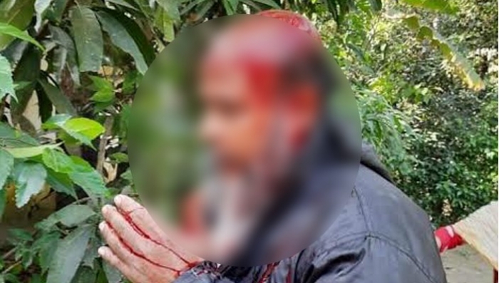 মেয়েকে উত্ত্যক্ত করায় প্রতিবাদ, মার খেলেন বাবা